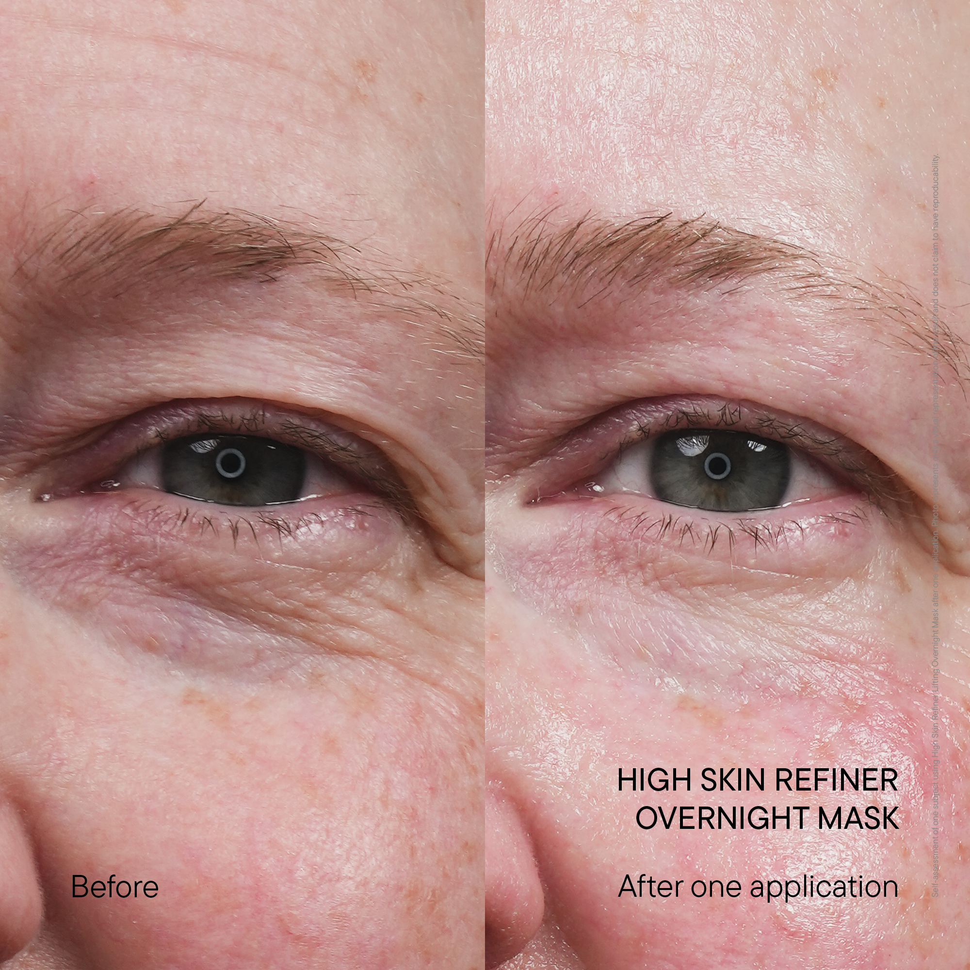 Before and after: visibly smoother-looking skin after one application