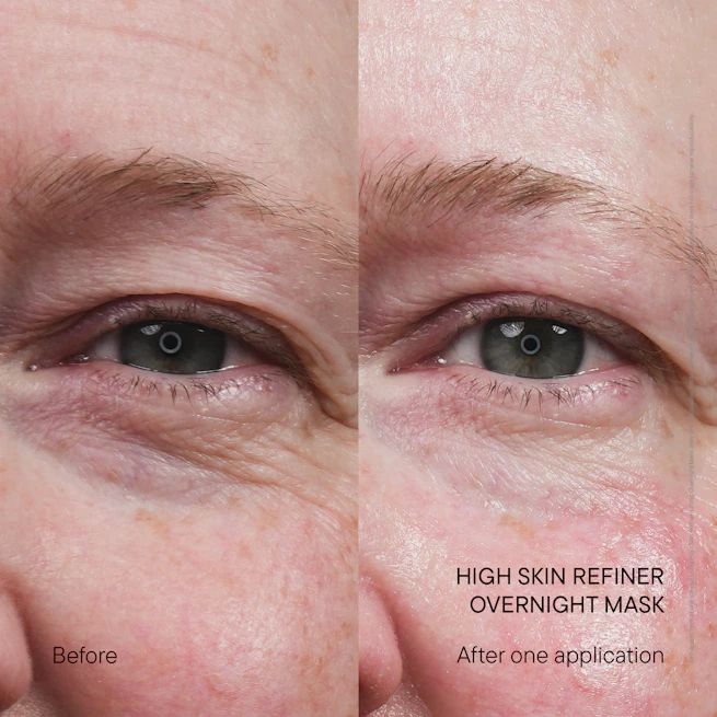 Before and after: visibly smoother-looking skin after one application