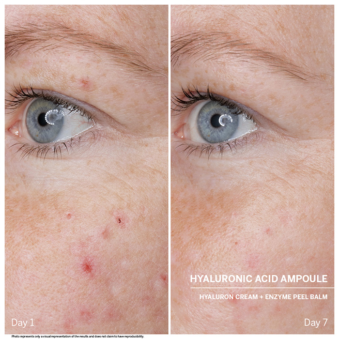 Was ist Hyaluron? Alles zur Wirkung & Anwendung BABOR Skincare Expert"